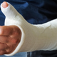 Image for article titled Vitamin D Supplements Fail to Prevent Bone Fractures in Large Clinical Trial